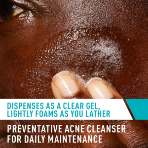 Acne Control Cleanser